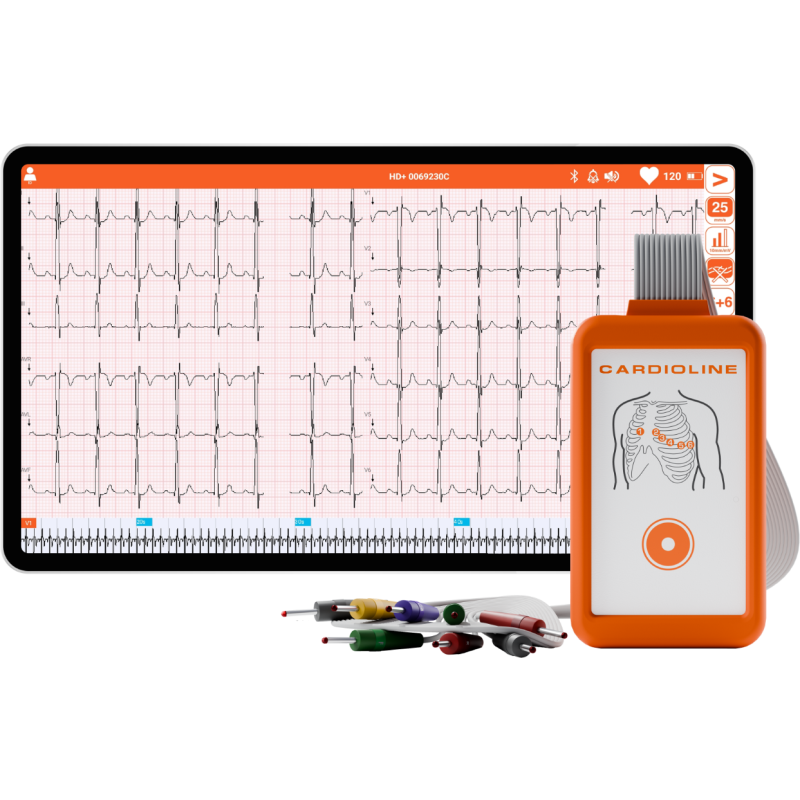Electrocardiographe ECG Cardioline Touchecg HD+ Bluetooth (12 pistes) pour Windows avec tablette 10