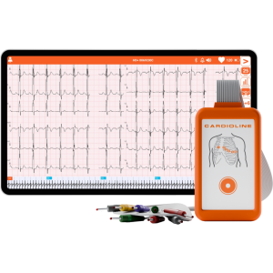 Electrocardiographe ECG Cardioline Touchecg HD+ Bluetooth (12 pistes) pour Android avec tablette 10