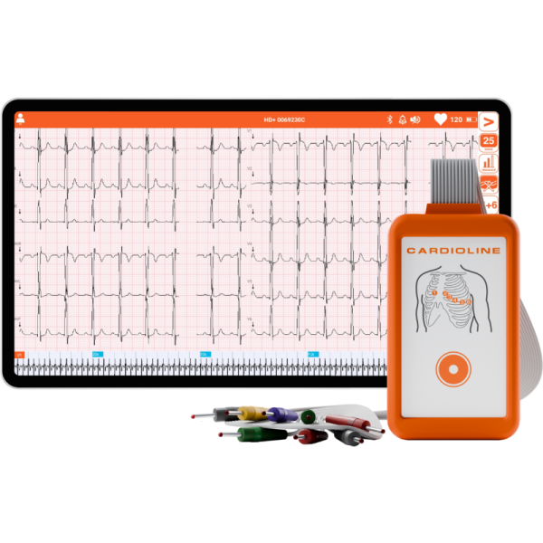 Electrocardiographe ECG Cardioline Touchecg HD+ Bluetooth (12 pistes) pour Android avec tablette 10
