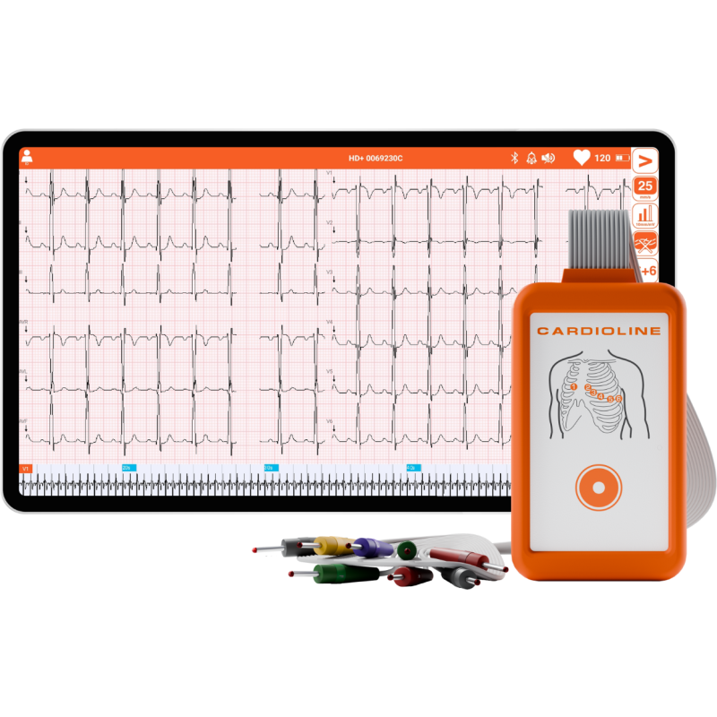 Electrocardiographe ECG Cardioline Touchecg HD+ Bluetooth (12 pistes) pour Android avec tablette 10