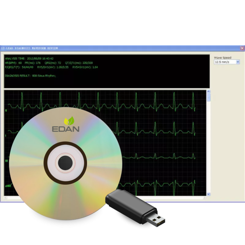 Logiciel PatientCare viewer pour moniteur multiparamètres Edan