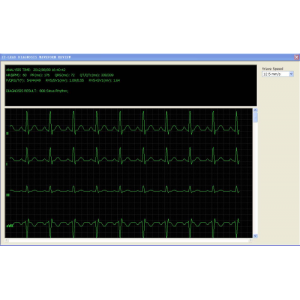 Logiciel PatientCare viewer pour moniteur multiparamètres Edan