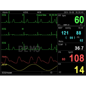 Moniteur patient multiparamétrique GIMA PC-3000 (PNI; SpO2; Temp.; Resp.;ECG)