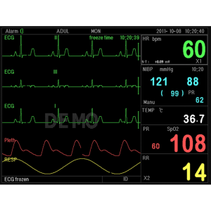 Moniteur patient multiparamétrique GIMA PC-3000 (PNI; SpO2; Temp.; Resp.;ECG)