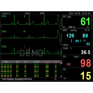 Moniteur patient multiparamétrique GIMA PC-3000 (PNI; SpO2; Temp.; Resp.;ECG)