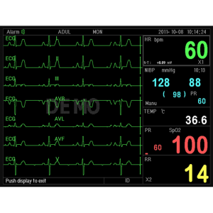 Moniteur patient multiparamétrique GIMA PC-3000 (PNI; SpO2; Temp.; Resp.;ECG)