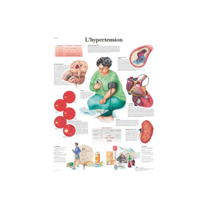 Planche anatomique sur l'hypertension 3bs Scientific