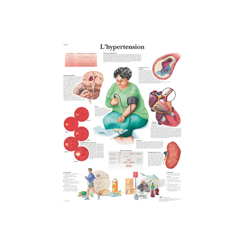 Planche anatomique sur l’hypertension 3bs Scientific